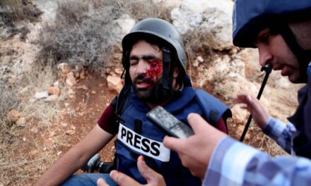 Uz pokrivanje lijevog oka iskazana solidarnost s palestinskim fotoreporterom