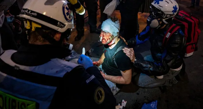 Počinje istraga u Francuskoj zbog napada policije na fotografa