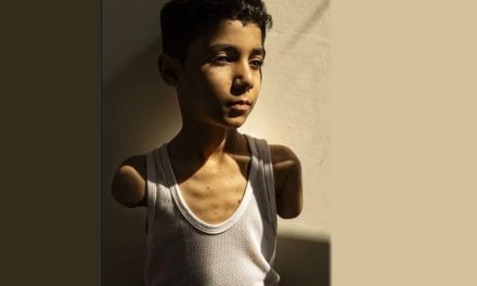 Fotografija palestinskog dječaka koji je ostao bez obje ruke proglašena najboljom fotografijom 2025. godine
