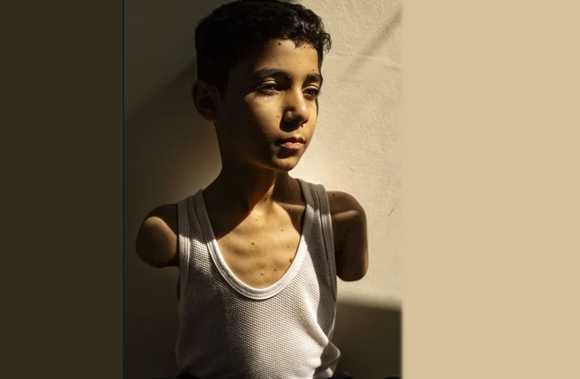 Fotografija palestinskog dječaka koji je ostao bez obje ruke proglašena najboljom fotografijom 2025. godine