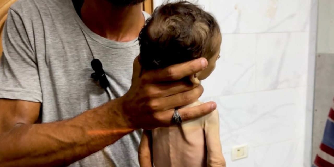 Kada tijela izgladnjele djece u Gazi dostignu „tačku bez povratka“