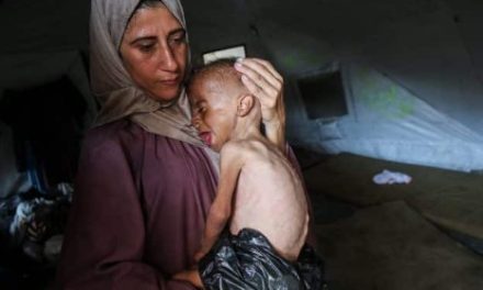 New York Times: Izrael ne izgladnjuje zdravu djecu do smrti. Samo onu s hroničnim bolestima